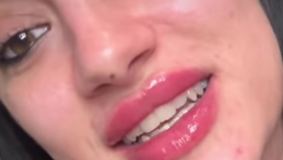 Barbara Bobak radila usta