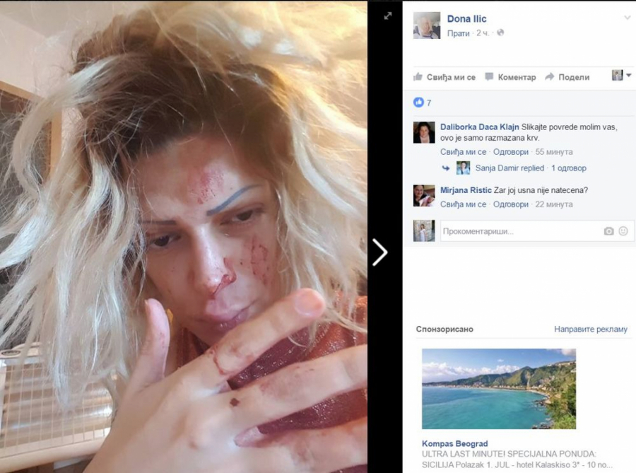 OVE NAŠE JAVNE LIČNOSTI SU PRETRPELE STRAVIČNO NASILJE I BATINE Njihova lica bila su sva u modricama i podlivima, a jedna je završila tragično!