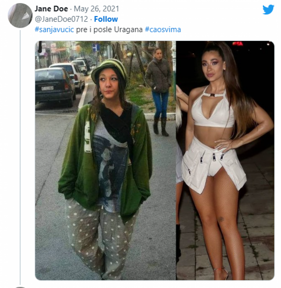 DA LI JE OVO ISTA OSOBA? Zanemećete kada vidite kako je Sanja Vučić izgledala pre svih operacija, neprepoznatljiva! (FOTO)