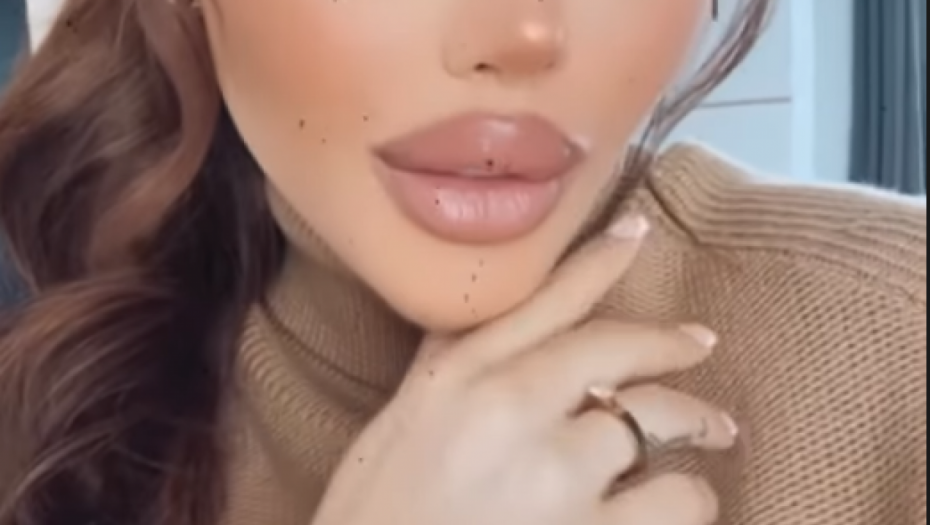 Ana Korać blista posle porođaja