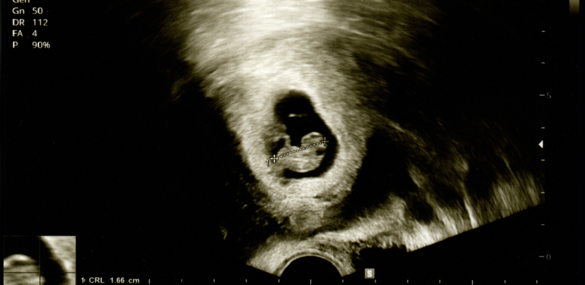 TO MU JE NAJGORI DAN U ŽIVOTU Muškarac otišao na ultrazvuk sa trudnom devojkom, pa saznao FRAPANTNU ISTINU