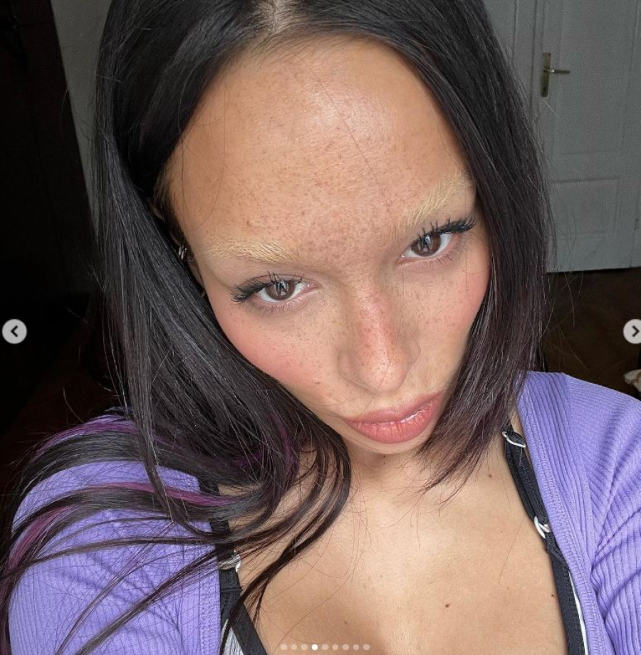 ALBINO STIL Edita novim imidžom fanove bacila u rebus, svi se pitaju gde joj je ovaj deo lica (FOTO)