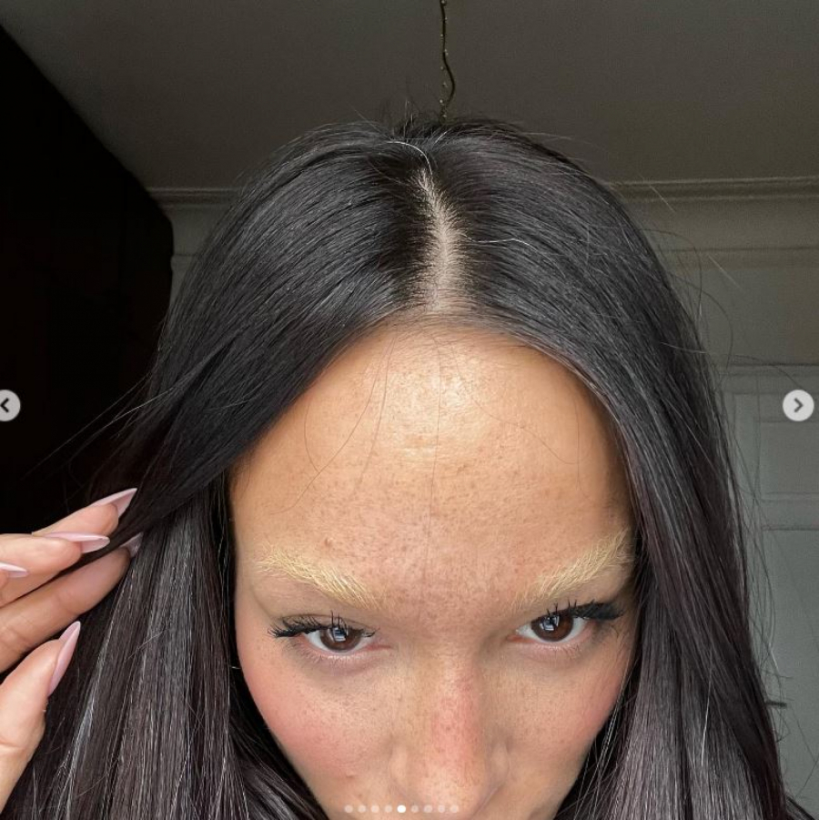 ALBINO STIL Edita novim imidžom fanove bacila u rebus, svi se pitaju gde joj je ovaj deo lica (FOTO)