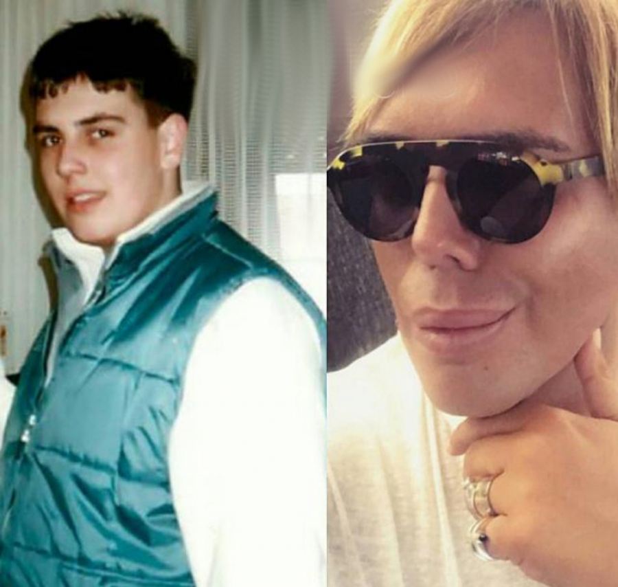 TRENUTNO JE U ŽIVOTNOJ OPASNOSTI, A EVO KAKO JE BOKI 13 IZGLEDAO PRE SVIH OPERACIJA Ni rođena majka ga ne bi prepoznala, zanemećete kada vidite razliku! (FOTO)