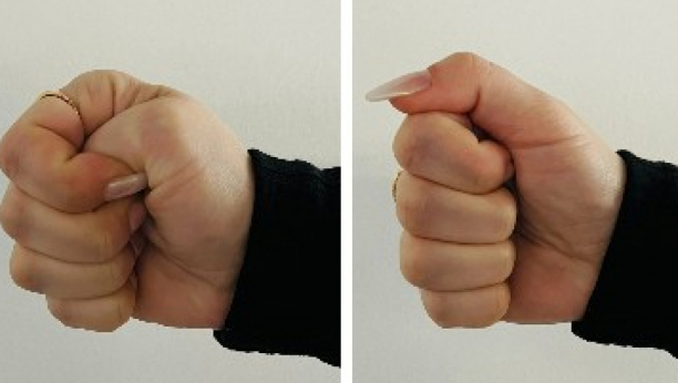 DOKTOR MI JE REKAO DA STEGNEM PESNICU Za tri sekunde čovek je znao sve o meni