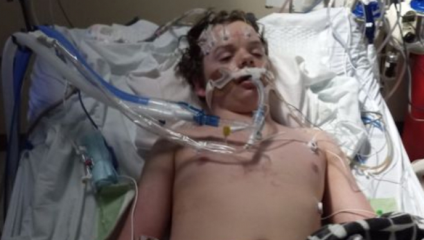 NIJE MU BILO SPASA Zbog TikTok izazova završio je na respiratoru, a onda su roditelji dečaka (13) čuli najgore vesti