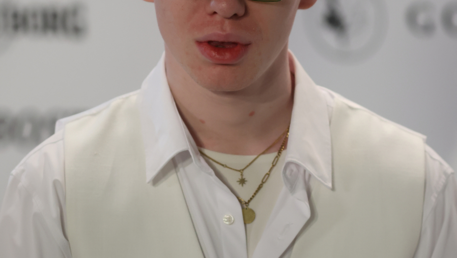 Albino 