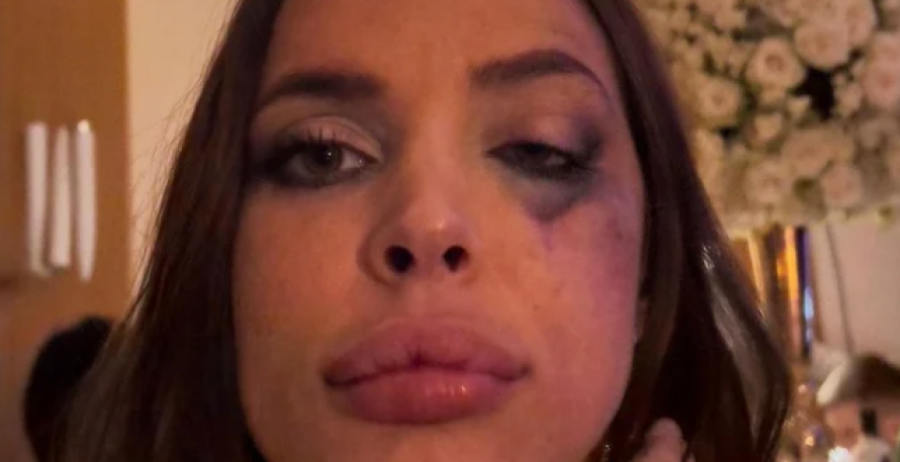 PROCURILE NEVIĐENE FOTKE IZ PROŠLOSTI NATAŠE ŠAVIJE Ni rođena majka je ne bi prepoznala, raskrinkano njeno pravo lice! (FOTO)