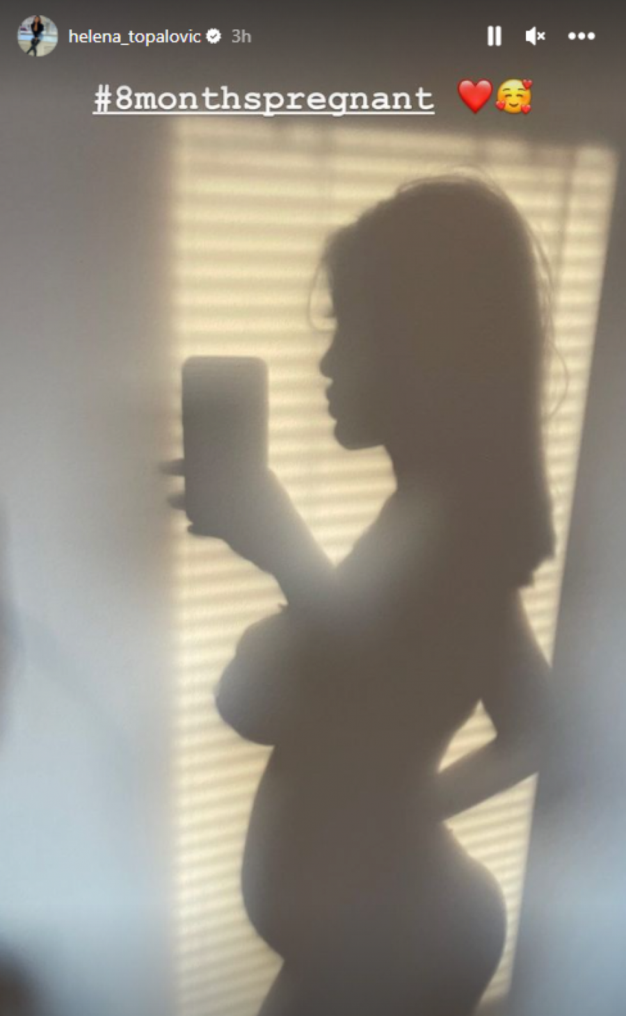 INTIMNA FOTKA TRUDNE TOPALKOVE ĆERKE Helena Topalović u osmom mesecu zapalila Internet, sve se ocrtava! (FOTO)