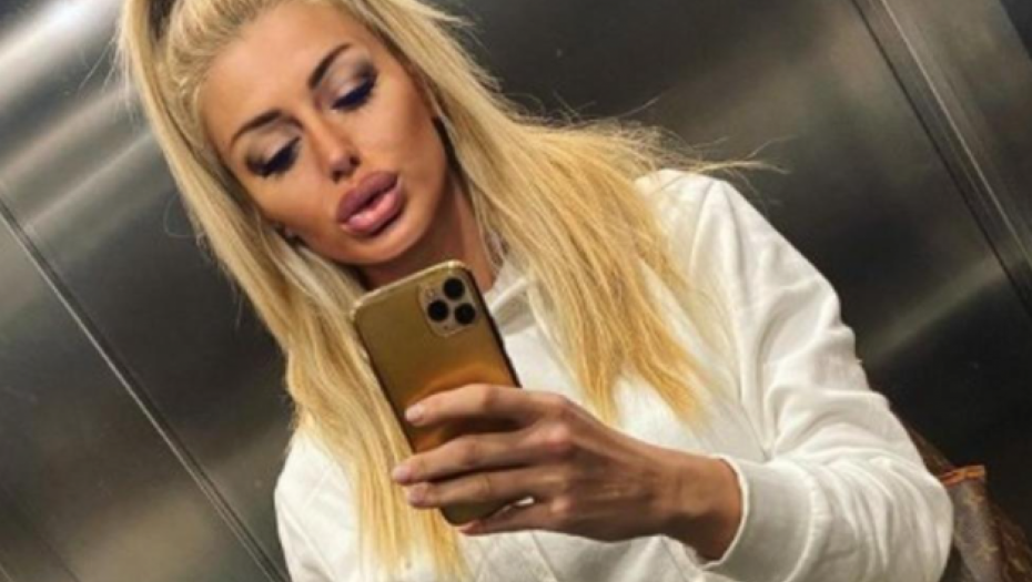 "MUŽ ME JE TUKAO U TRUDNOĆI"! Manekenka prošla kroz golgotu i nasilje, jedva izvukla živu glavu, a evo kako danas izgleda