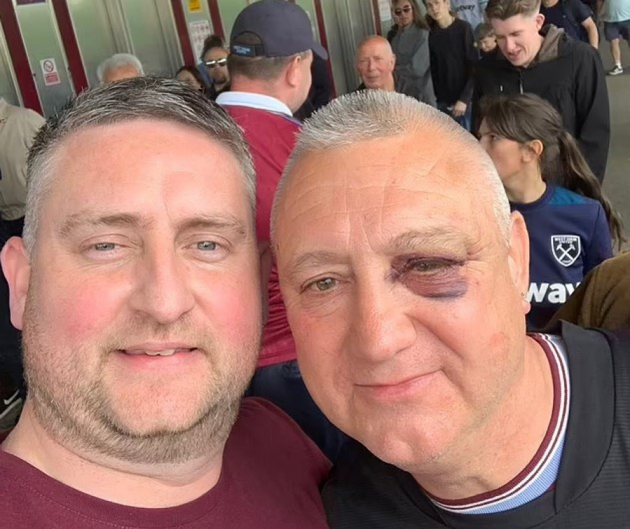 POMOĆ HEROJU Prebio huligane, zaradio šljivu, pa dobio kartu za meč: Gledaće „srpsku“ Fjorentinu