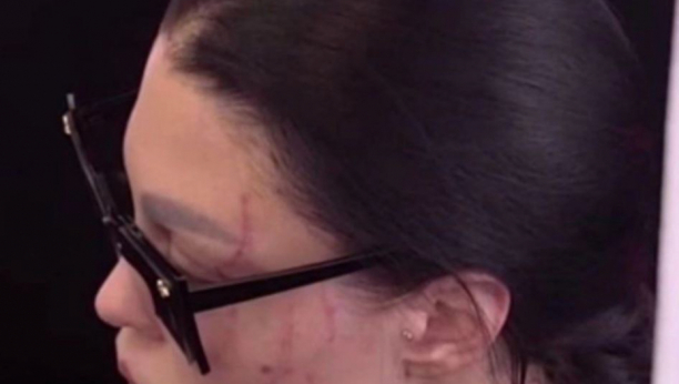 STRAVIČNO! Maja Marinković prekrila užasne povrede nakon što ju je Anđela pretukla, kamere snimile uznemirujući prizor (FOTO)