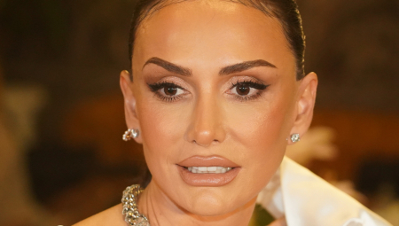 Emina je javno priznala samo jednu plastičnu operaciju, korekciju nosa