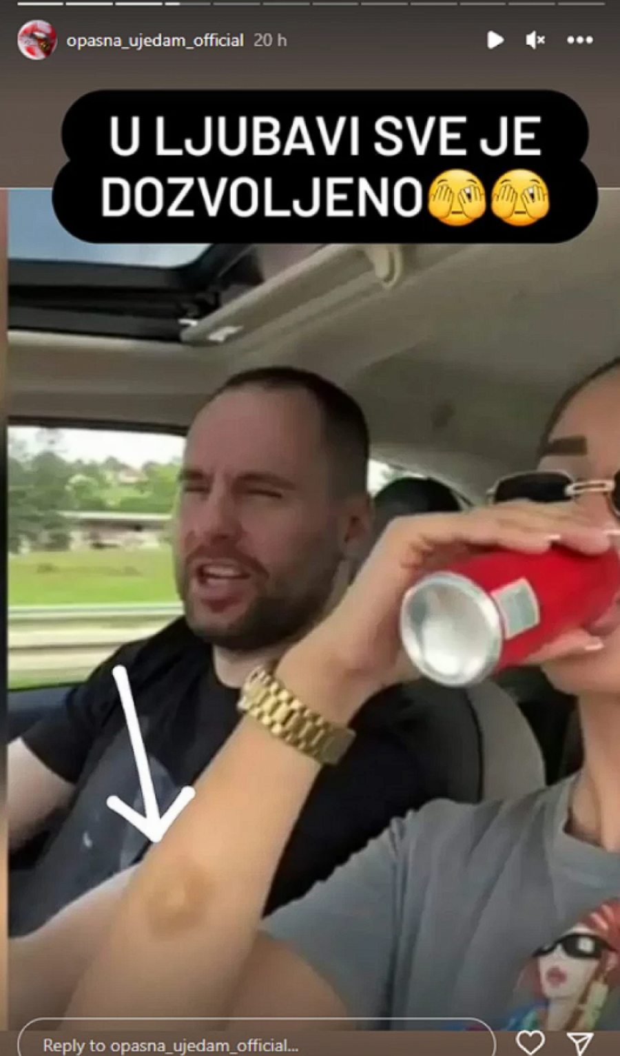 Anđela ima modricu na ruci