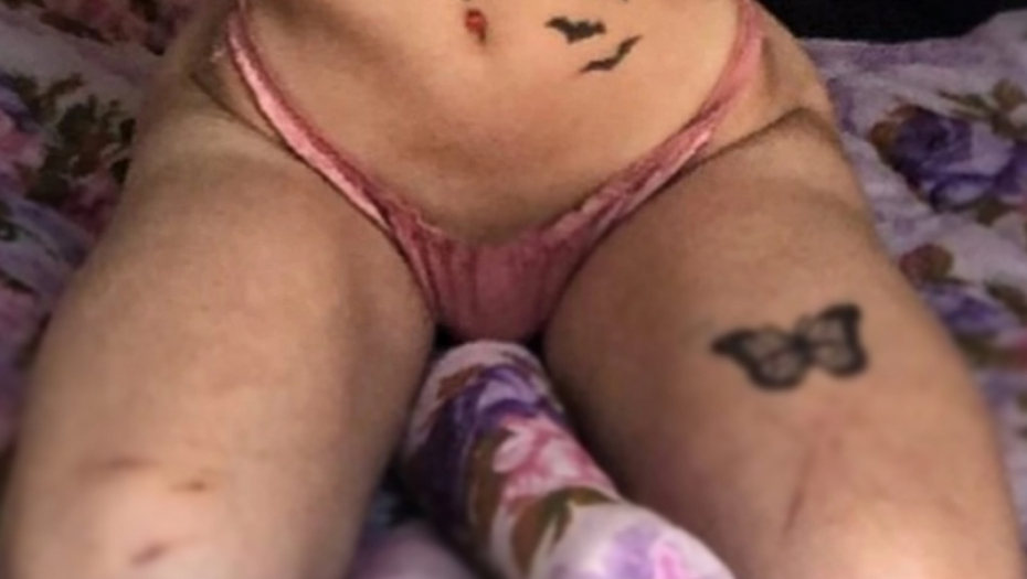 Ožiljci nastradale Noe