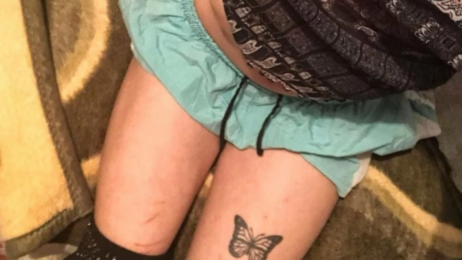 Ožiljci nastradale Noe