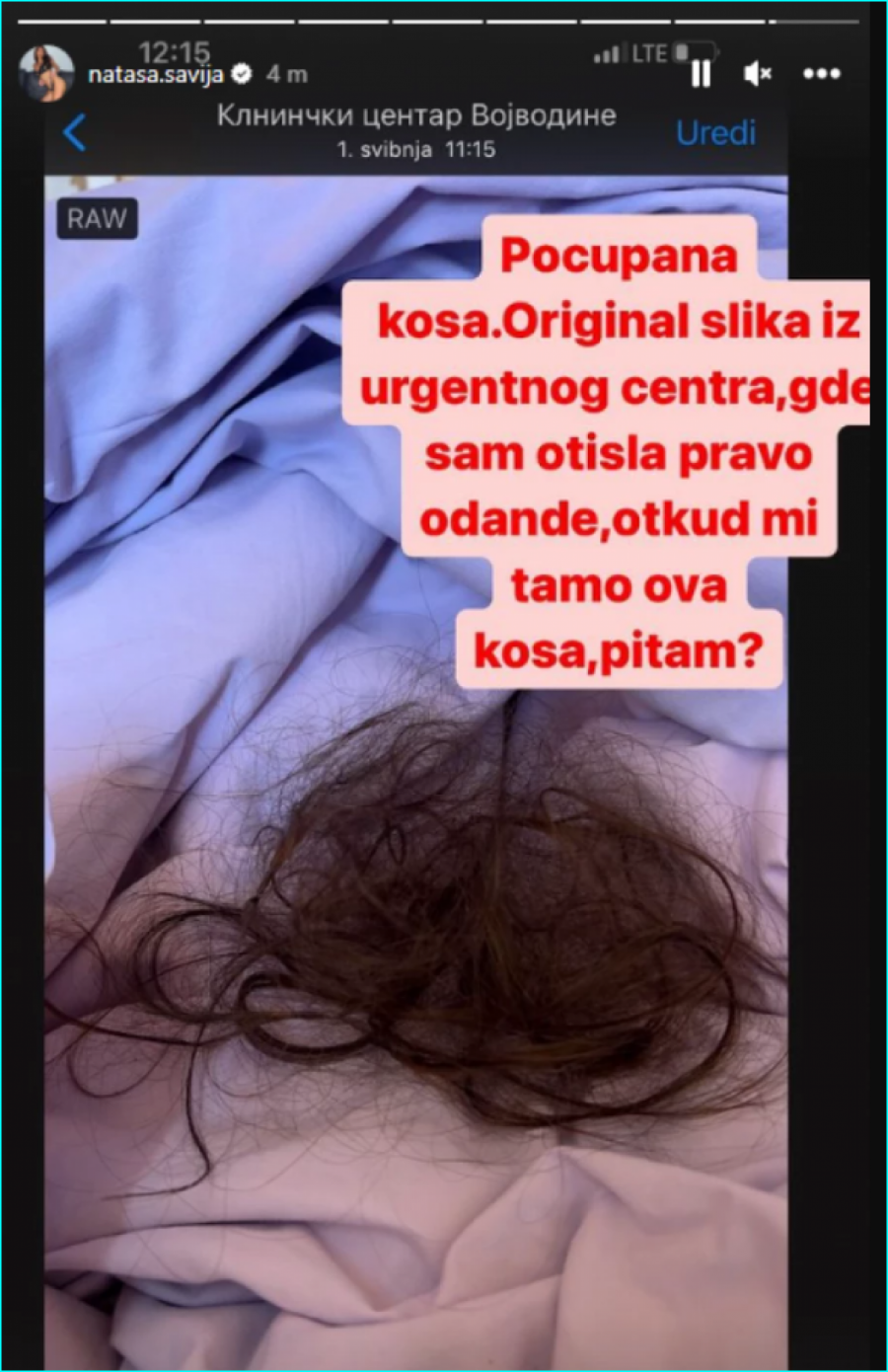 Šavijina kosa