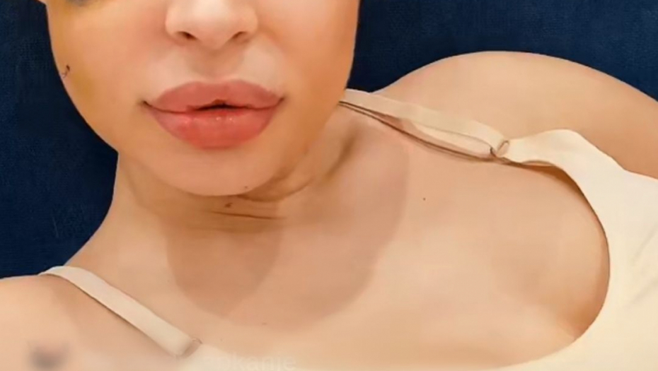 Nataša Šavija  nakon operacije 