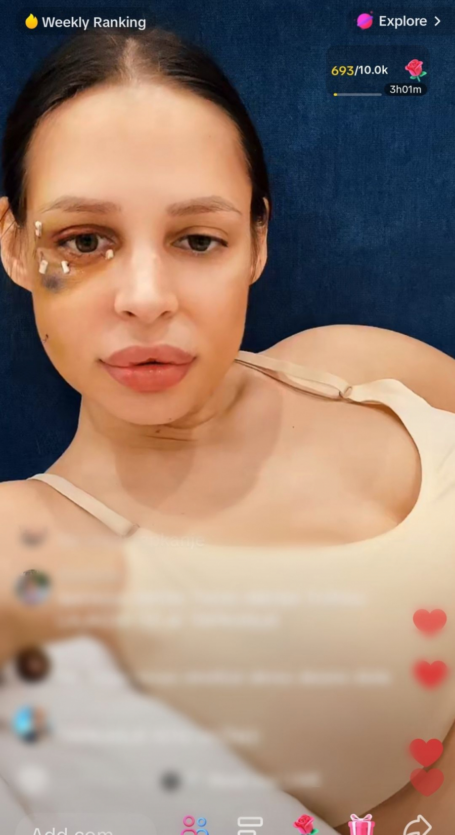 Nataša Šavija nakon operacije