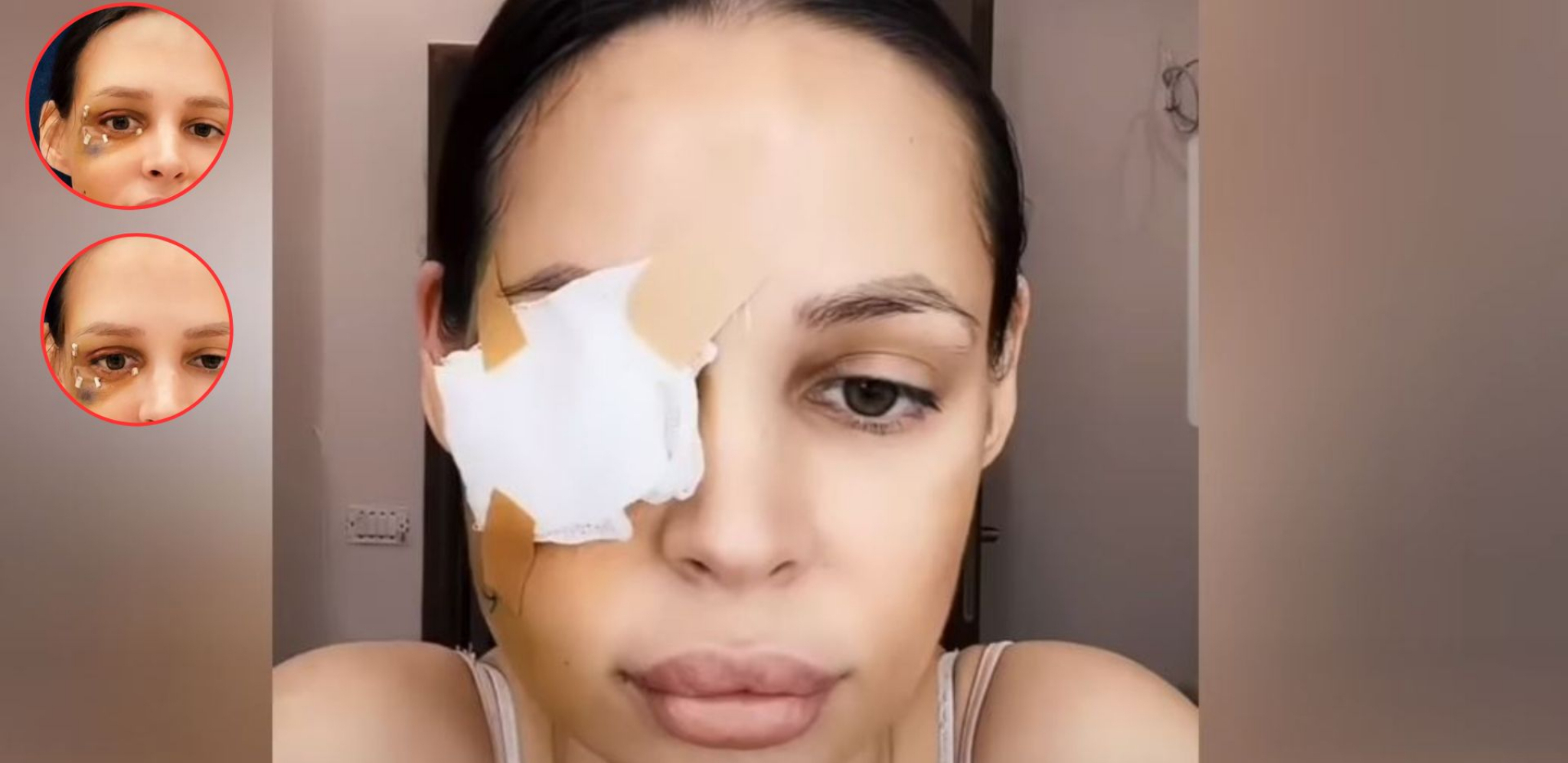 Nataša Šavija nakon operacije