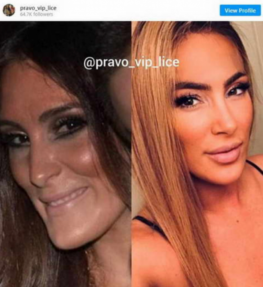 Senidah pre operacija