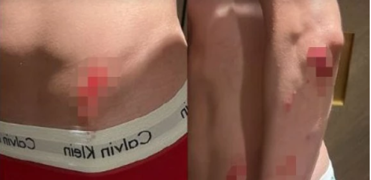 Naš influenser doživeo nezgodu