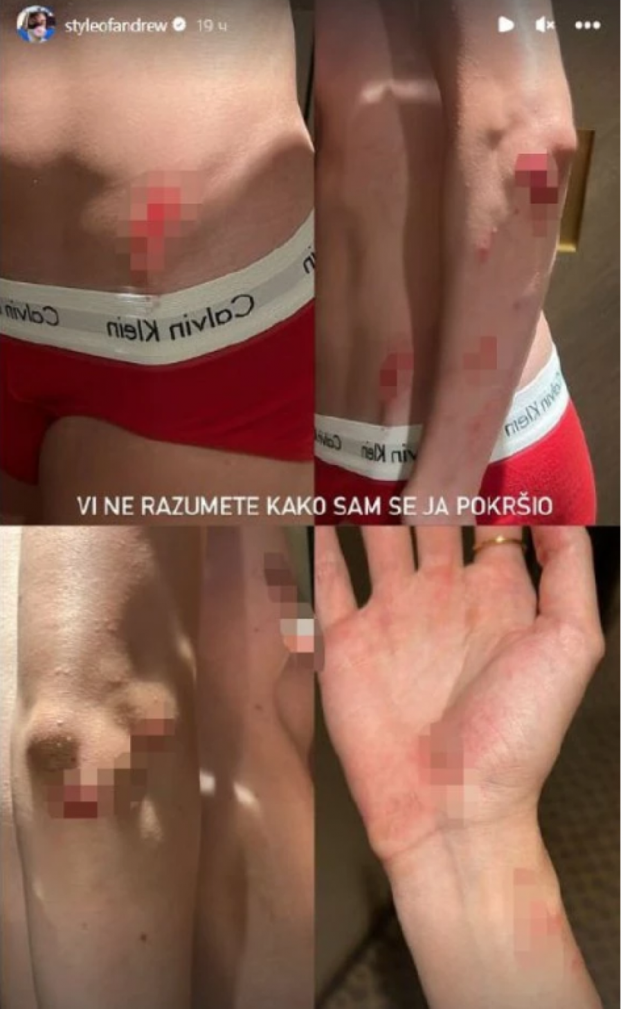 Naš influenser doživeo nezgodu