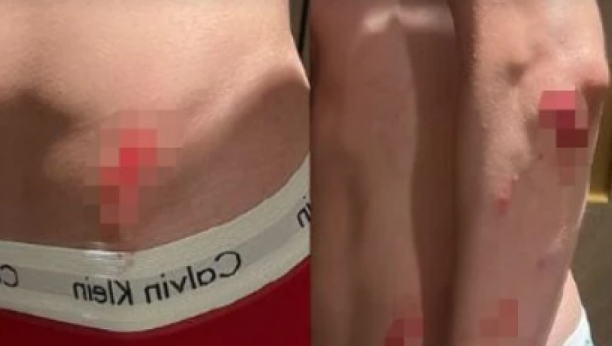 Naš influenser doživeo nezgodu