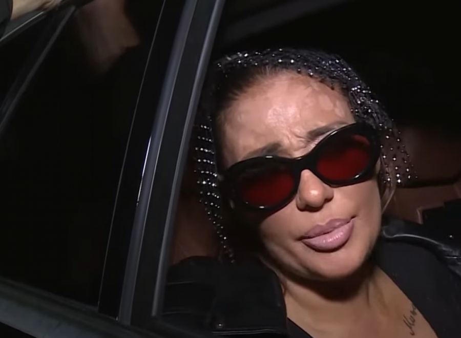 Ana Nikolić ima kratere na licu