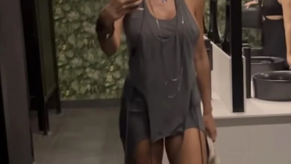 Sindi pokazala bradavice