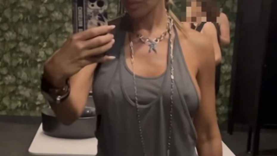 Sindi pokazala bradavice