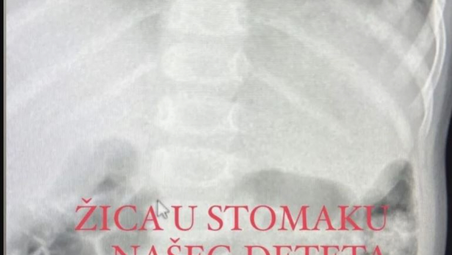 Deca pojela žicu u kolačima