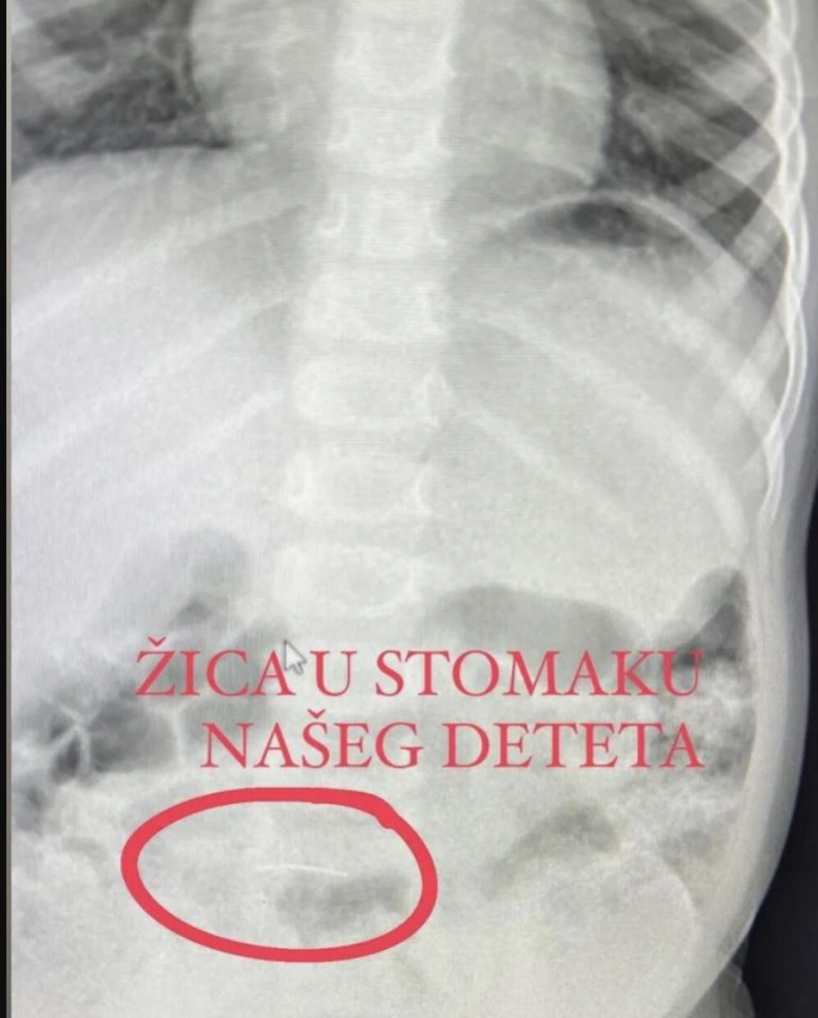 Deca pojela žicu u  kolačima