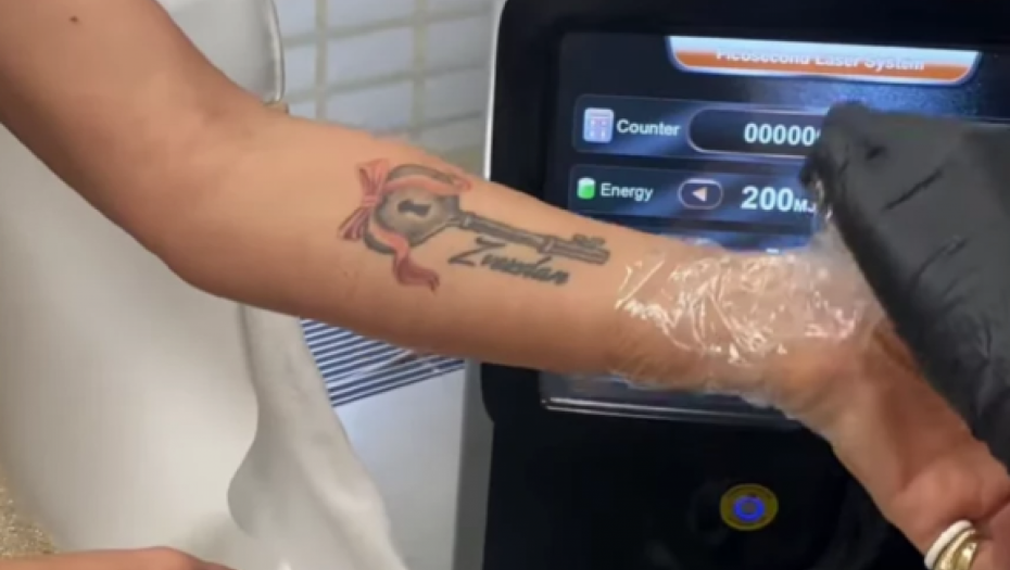 Ana uklonila tetovažu posvećenu Zvezdanu