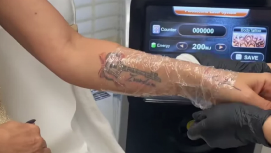 Ana uklonila tetovažu posvećenu Zvezdanu