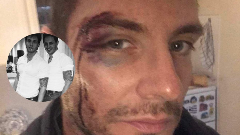 Mladić koji se ubio pretukao Mihića