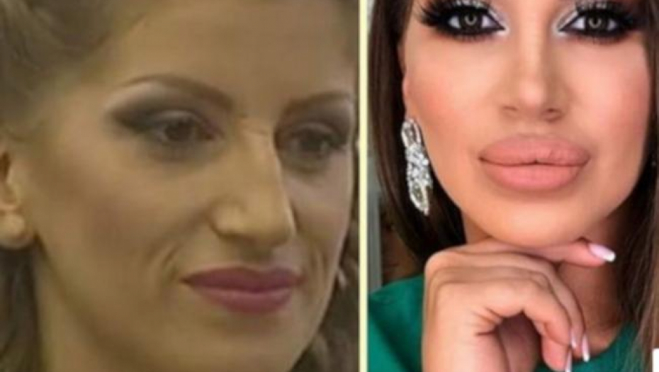 Dalila Dragojević pre operacija