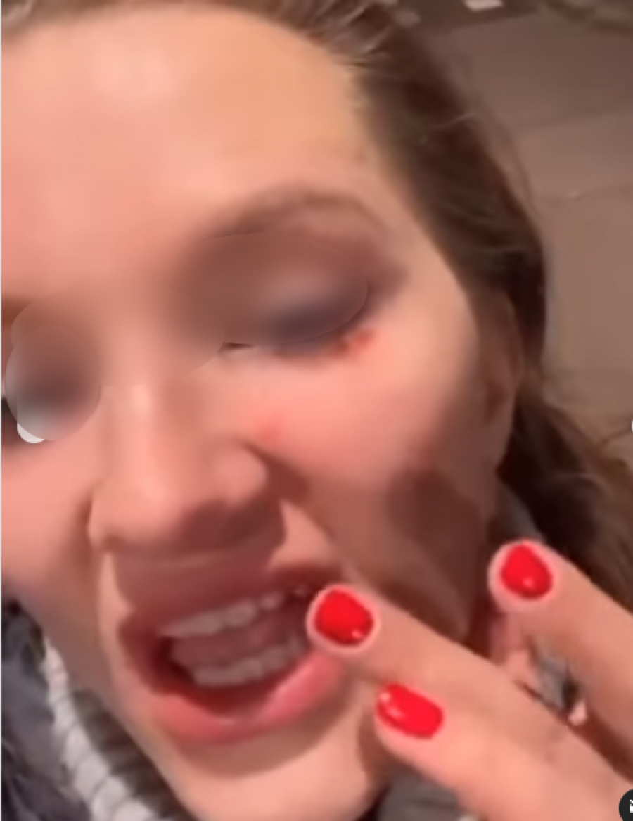 franš, napad, majka i dete