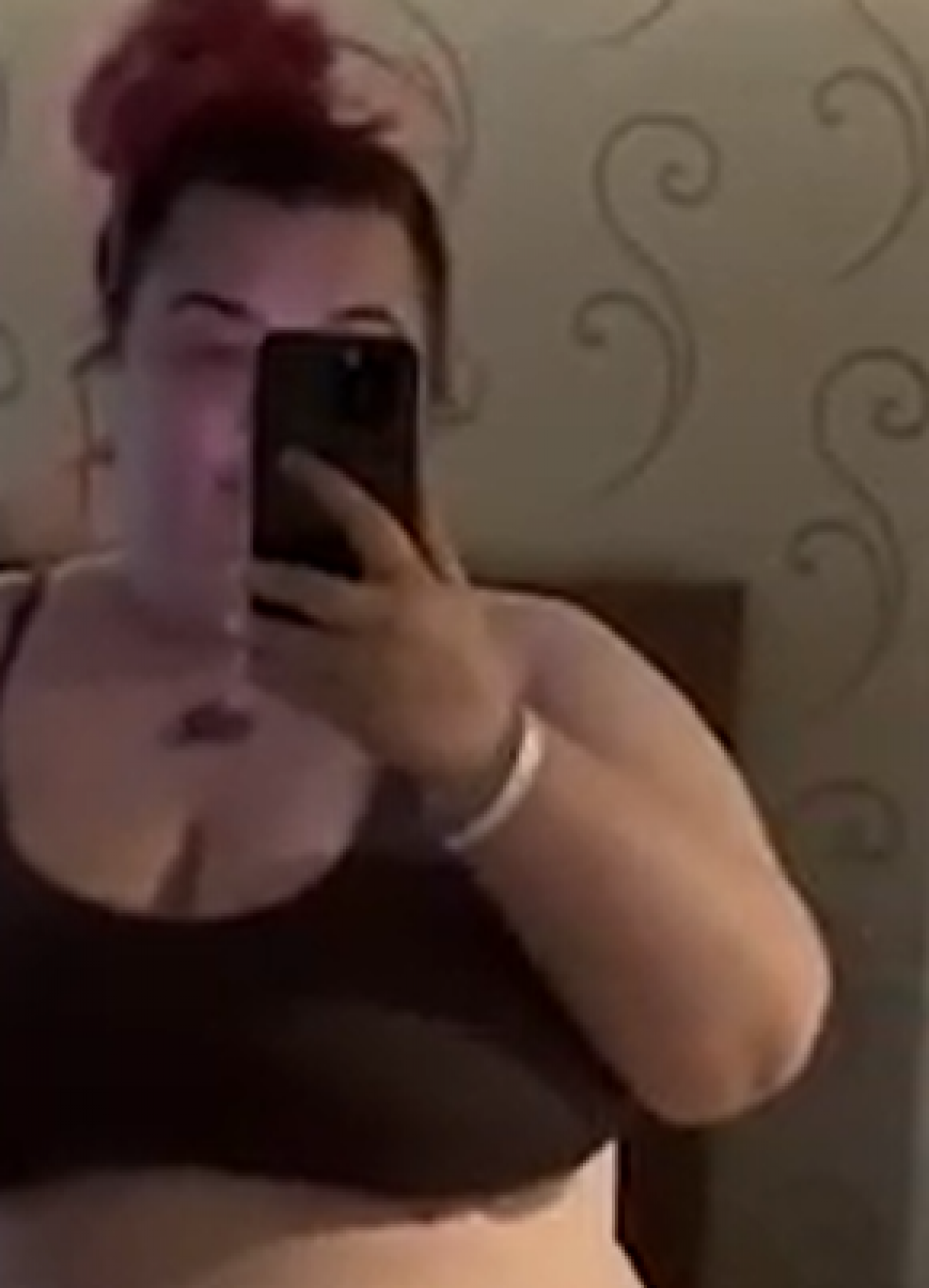 devojka nakon operacije