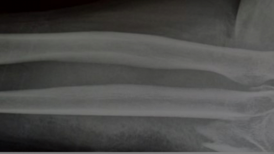 aligator napao muškarca