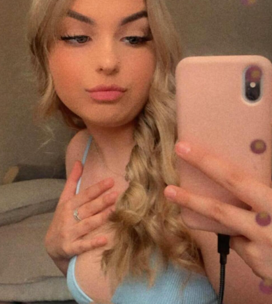 Ela Rik otkrila da ima tumor na mozgu