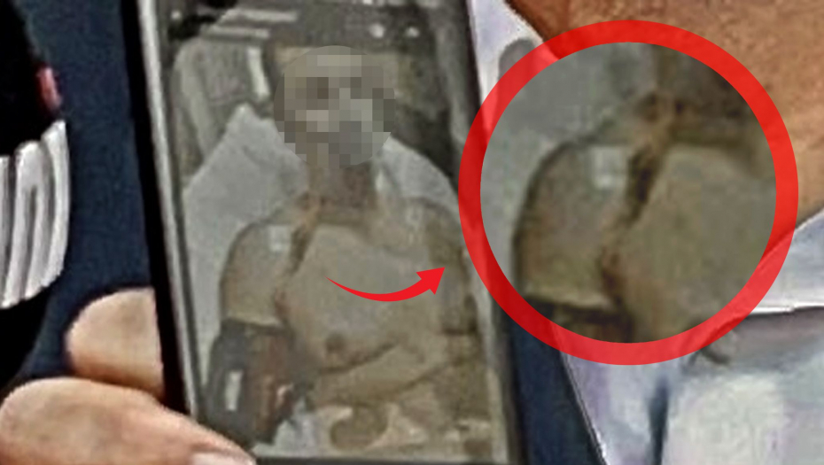 Žandarm pogođen strelom iz samostrela