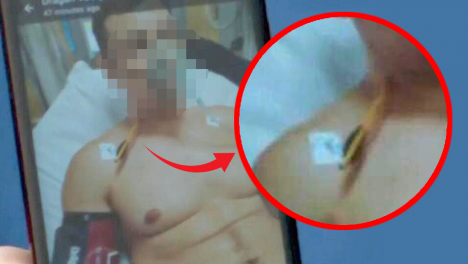 Žandarm pogođen strelom iz samostrela