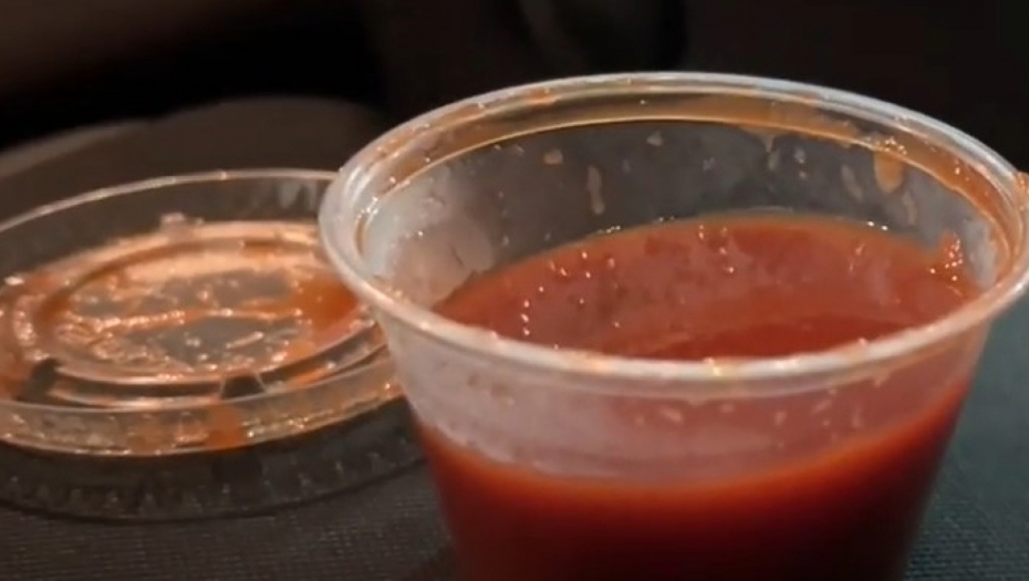 devojka se opekla na sos