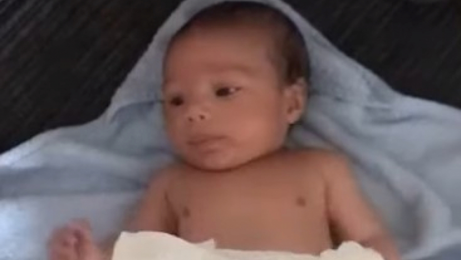 beba ima problem sa vidom