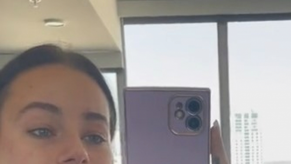 devojka povećala usne