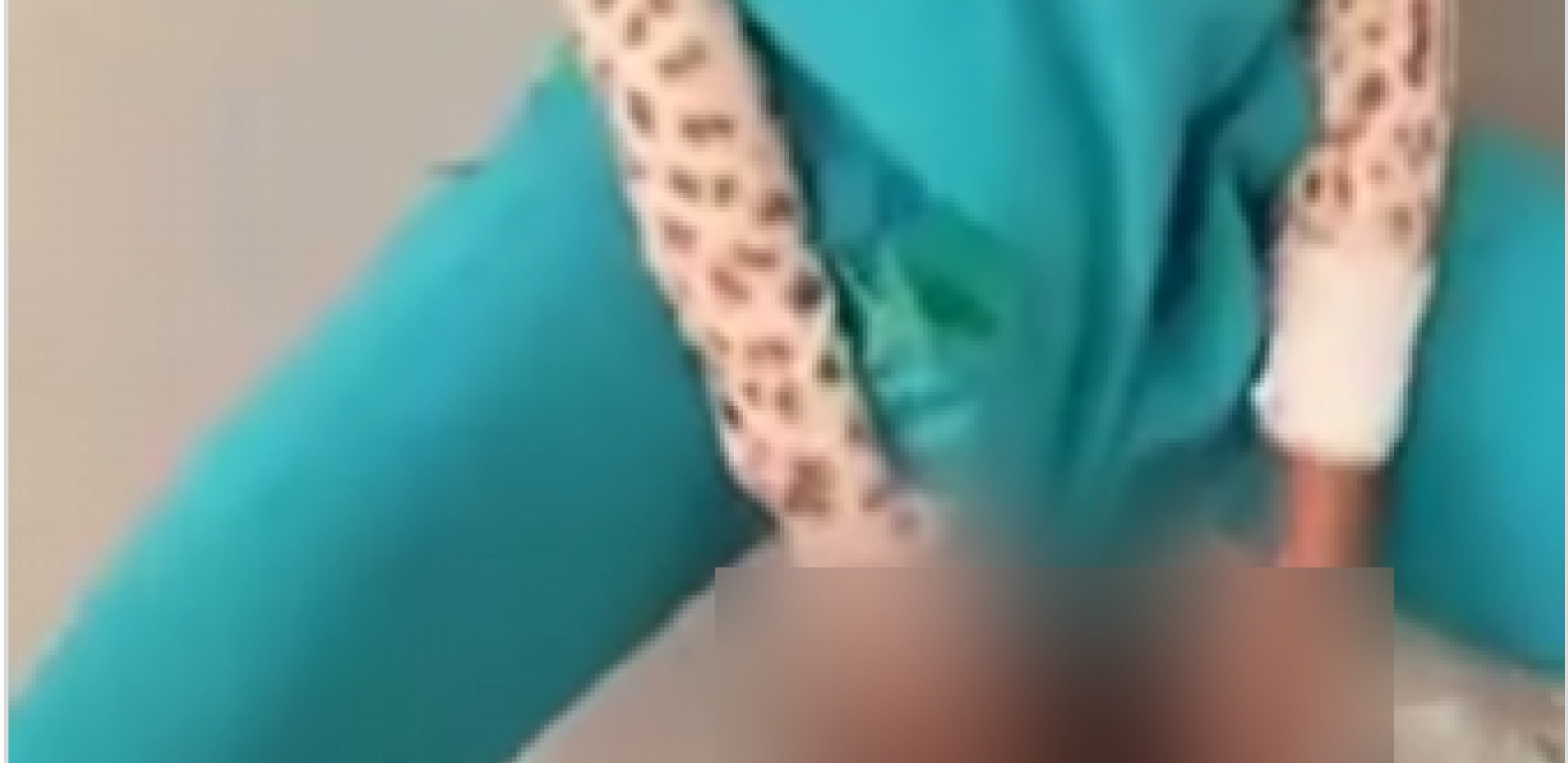 Tverkuje pacijentu ispred lica u SAD