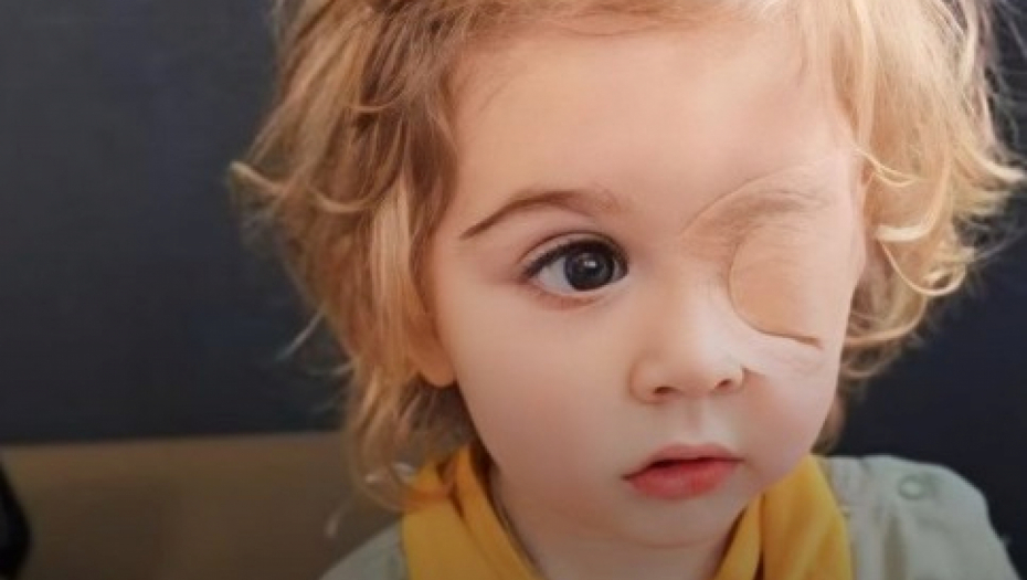 dečak infekcija oka