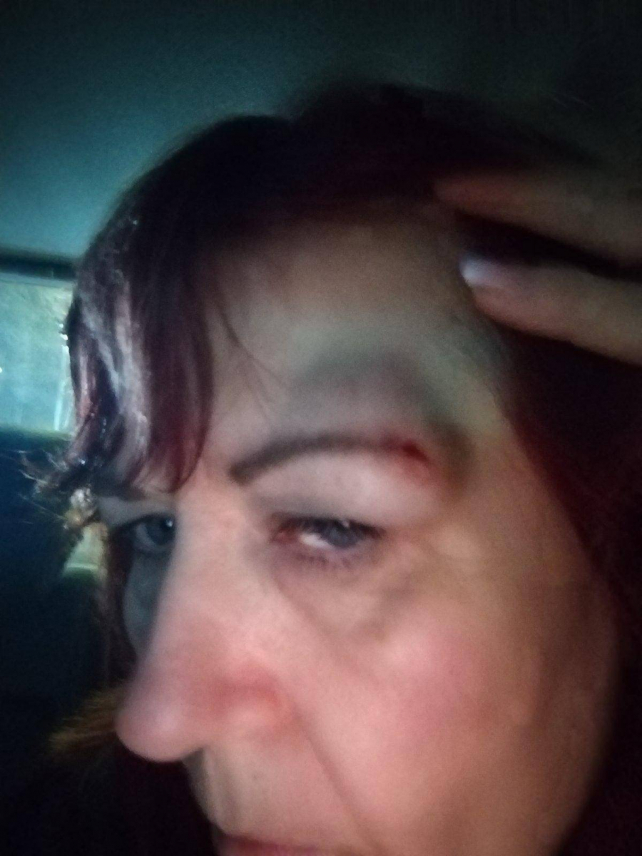 Danijela Krstić povrede