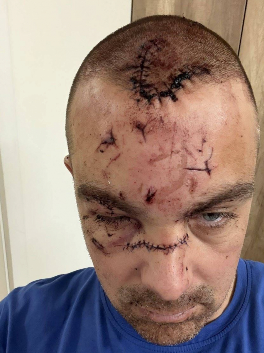 Mladić kojeg je napao Karlik Džons